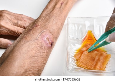 Wound Dressing, Doctor Cleaning And Wash Infected Wound In Chronic Diabetes Patient With Normal Saline And Povidone Iodine, Accidental Wound Care Treatment In Elder Old Man.