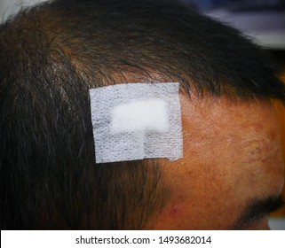 Wound Dressings Wound Around Head Stock Photo 1493682014 | Shutterstock