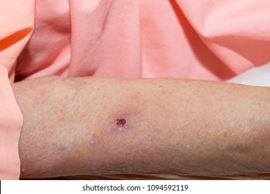 scabs images stock photos vectors shutterstock why do scabs form