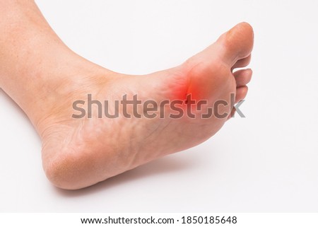 Wound on the foot, leg of an elderly woman on a white background