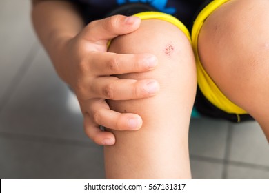 Wound On The Knee Of A Small Child