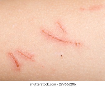 Royalty Free Cut Skin Stock Images Photos Vectors Shutterstock