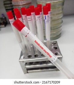 Wound swab for Varicella-Zoster Virus PCR test, laboratory background.