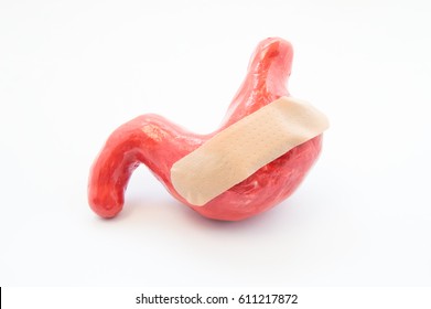 Wounded stomach. Anatomical shape of human stomach with strip of adhesive bandage or plaster on it. Concept photo damaged gastric due to ulcer, erosion, gastritis, hyperacidity and its treatment - Shutterstock ID 611217872