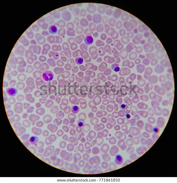 Wrightstained Peripheral Blood Smear Newborn X1000 Stock Photo