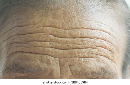 Wrinkled Forehead On Old Women