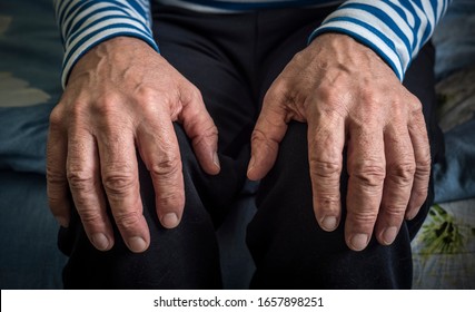 Wrinkled Hands Of An Elderly Man On His Lap