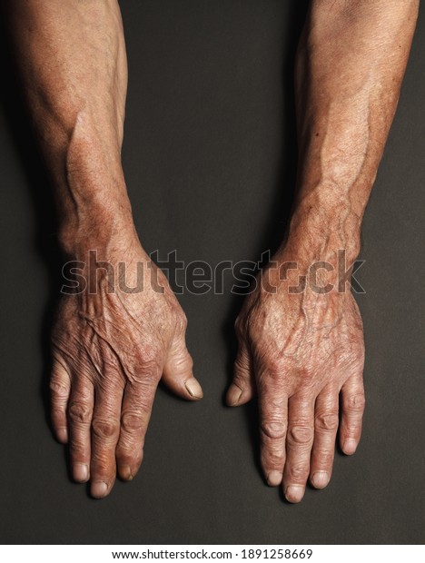 Wrinkled hands of an elderly man on\
a table close-up isolated on a black background. Top\
view.