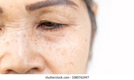 wrinkled and lines of old asian woman eyelid skin texture in closeup selective focus