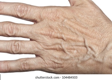 Wrinkled Woman Skin On Hand