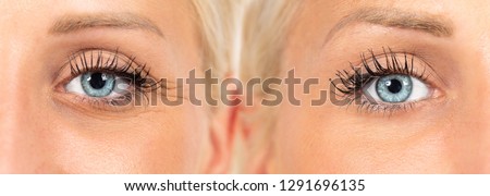 wrinkles cosmetic treatment, images composition showing results 