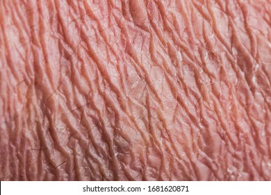 Wrinkly Skin Texture On Back Side Of Hand