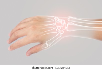 wrist bones injury white background wrist pain - Shutterstock ID 1917284918