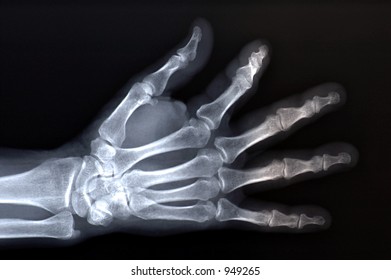 X Ray Stock Photo 949265 | Shutterstock