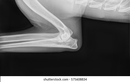 X Ray Of Elbow Dysplasia