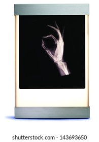 X Ray Of Hand On Lightbox