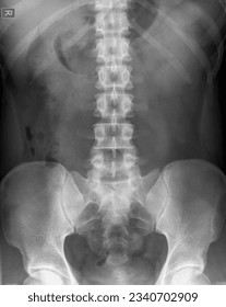 X ray image of healthy lumbosacral spine ap view - Shutterstock ID 2340702909