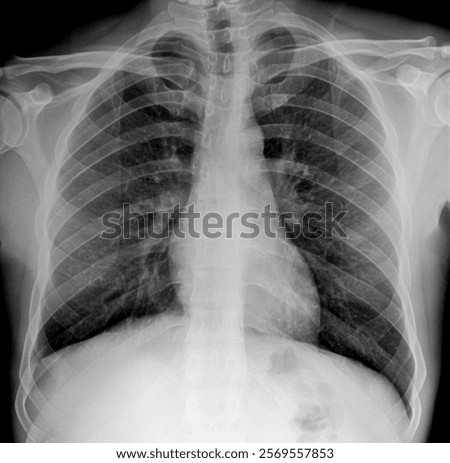X ray photo image of chest area