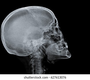 Photo de stock Xray Images Wild Animals Used By 1316238251 | Shutterstock