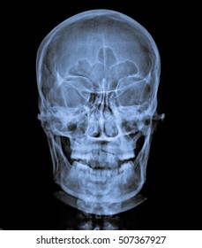 X Ray Skull Front View Stock Photo 507367927 | Shutterstock