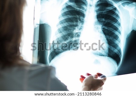 x ray thorax,doctor looks at the picture in the hospital for pneumonia and cancer