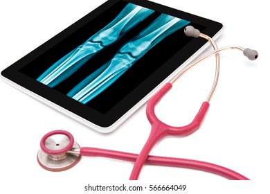 Xray Application On Tablet, Fast Review On Smart Phone, Smart Medical Conception On White Background