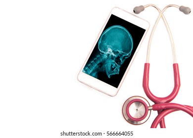 Xray Application On Tablet, Fast Review On Smart Phone, Smart Medical Conceptionon White Background