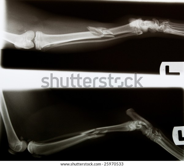 Xray Cats Broken Leg Before Surgery Stock Photo (Edit Now ...