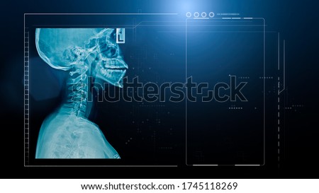 x-ray cervical spine with part of skull