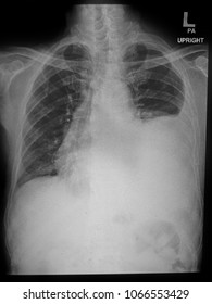 Chest Xray Child Show Neck Thorax Stock Photo (Edit Now) 429951187