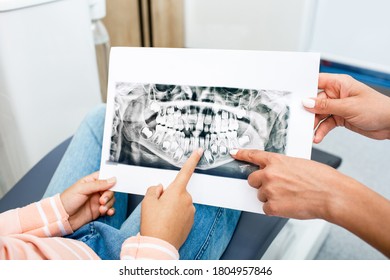 X-ray Of Children's Teeth. Milk And Molars Are Visible In The Picture, Close-up