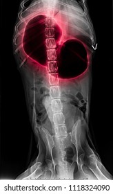 X-ray Of Dog Anterior View Red Highlight In Gastric Dilatation Volvulus Or Stomach Twists- Double Bubble Pattern Indicates Stomach Torsion Has Occurred- Veterinary Medicine- Veterinary Anatomy Concept