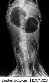 X-ray Of Dog Anterior View With Gastric dilatation Volvulus “GDV” Or Stomach Twists- Double Bubble Pattern Indicates Stomach Torsion Has Occurred-Veterinary Medicine And Veterinary Anatomy Concept.