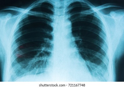 Xray Film Stock Photo 721167748 | Shutterstock