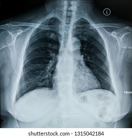 Human Chest Anatomy Images, Stock Photos & Vectors | Shutterstock