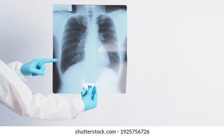 Xray Film Of Covid 19 Lung Damage And Holding By Doctor Hand In Medical Glove And PPE Or Personal Protection Equipment Suit. Studio Shot. Coronavirus Pandemic X Ray Film. Healthcare Medical Concept.
