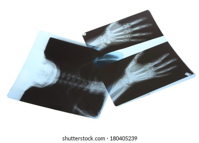 Xray Film Cutout On White Background