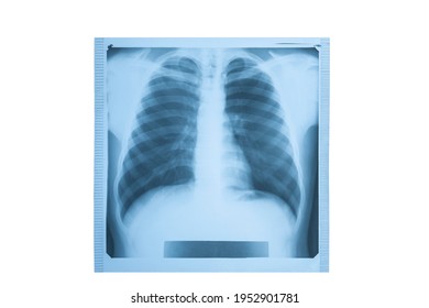 Thorax Images Stock Photos Vectors Shutterstock Thorax Images Stock Photos Vectors Shutterstock