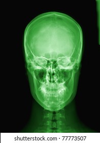 X-ray of green Alien's skull  / Many others X-ray images in my portfolio.