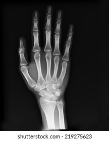 X-ray of hand - Shutterstock ID 219275623