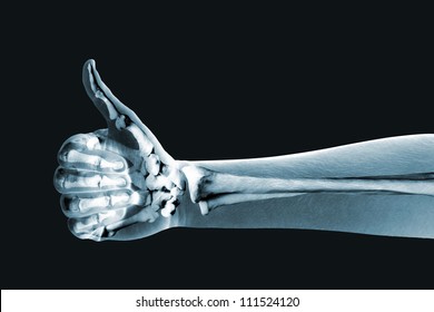 x  ray hand black background