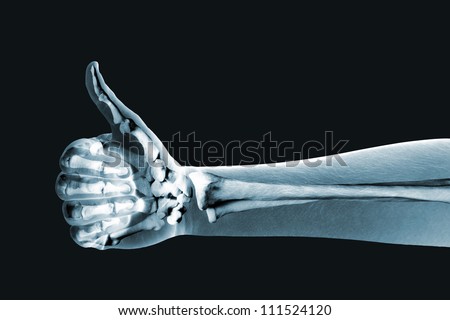 x-ray hand on black background