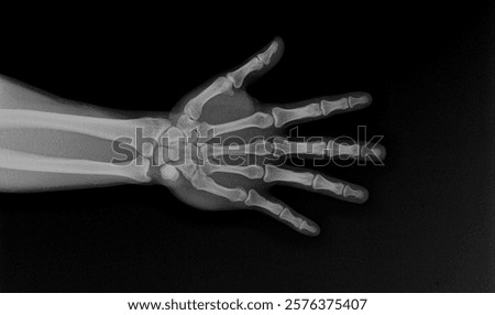 x-ray of the hand and wrist bones