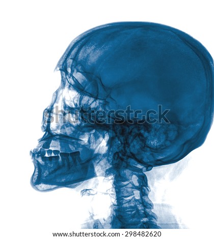 X-ray Head