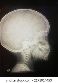 X-ray, Head,brain, Skull, Anatomy,image,bones,medicine,radiology,skeleton,anatomy,human,inside,up, Left,medical,healthy,broken, Strong,doctor,photo, Examinations,neck, Alien,patient. Children,kid,body