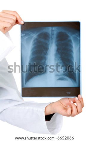 xray held by hands isolated over a white background