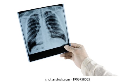 X-ray of human lungs at doctor's hand isolated on white background, medical worker examines lung disease.