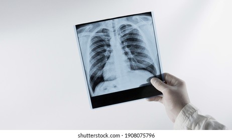 X-ray of human lungs on a white background at a doctor in the hands of an X-ray lung, a medical worker analyzes the disease of pneumonia, respiratory disease. - Powered by Shutterstock