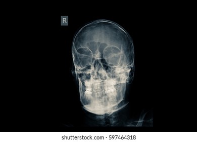 Xray Human Skull Stock Photo (Edit Now) 597464333