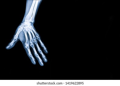 X-ray image of hand with copy space for text.
